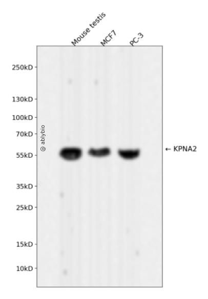 KPNA2 Rabbit mAb