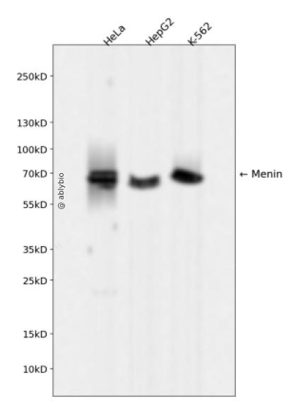 Menin Rabbit mAb