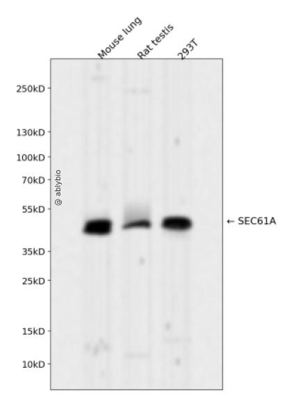 SEC61A Rabbit mAb