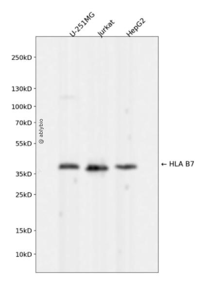 HLA B7 Rabbit mAb