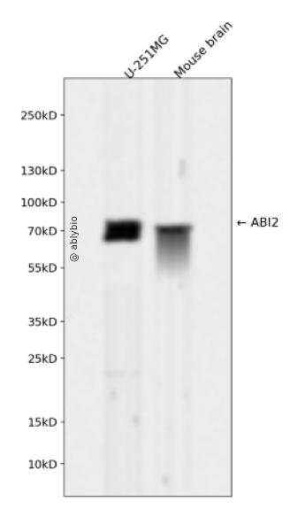 ABI2 Rabbit mAb