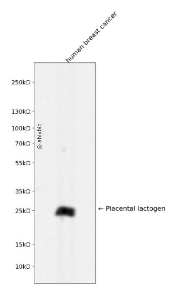Placental lactogen Rabbit mAb