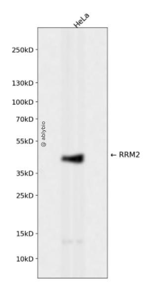 RRM2 Rabbit mAb