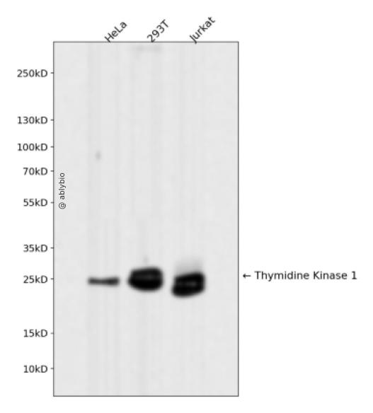 Thymidine Kinase 1 Rabbit mAb