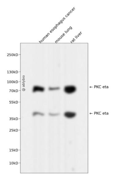 PKC eta Rabbit mAb