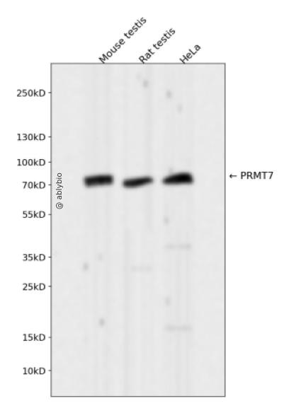 PRMT7 Rabbit mAb