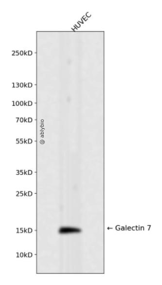 Galectin 7 Rabbit mAb