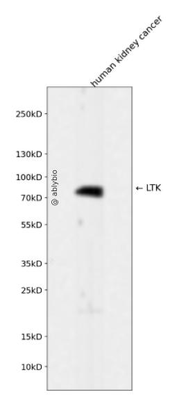 LTK Rabbit mAb