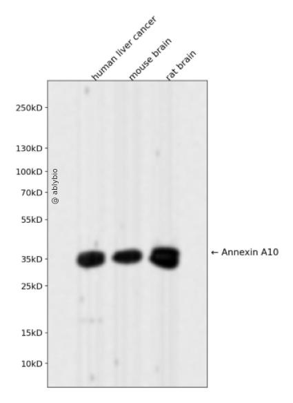 Annexin A10 Rabbit mAb