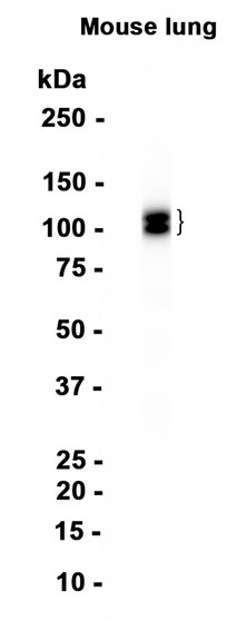 CD31 (YD20745) Rabbit mAb