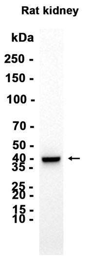 AYD15711