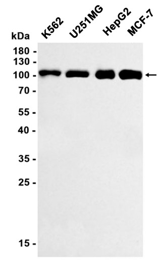DNA Ligase IV (YD15373) Rabbit mAb