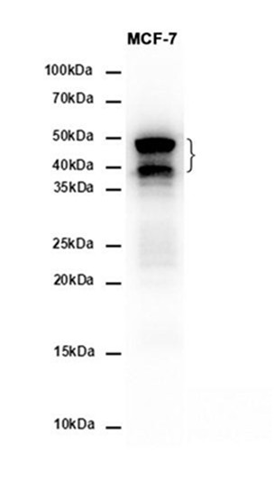 Cytokeratin 7 (YD13480) Rabbit mAb
