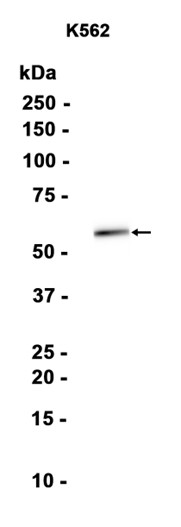 AYD15199