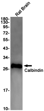 Calbindin (YD20673) Rabbit mAb