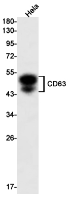 AYD12387