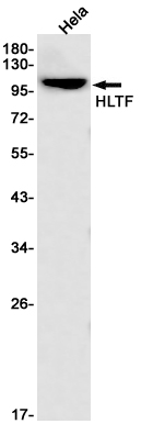 AYD11755