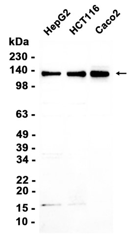AYD15100