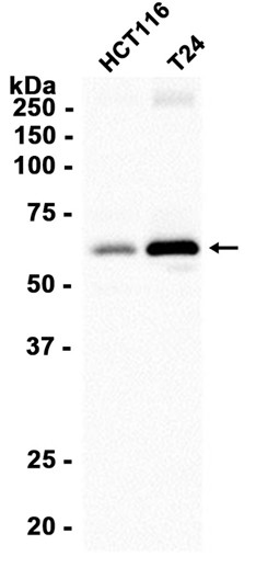 SQSTM1/p62 (YD13645) Rabbit mAb