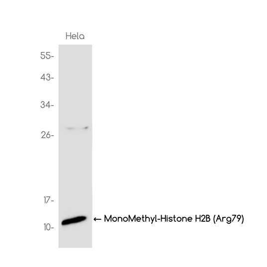 MonoMethyl-Histone H2B (Arg79) (YD32911) Rabbit mAb