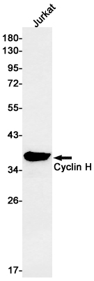 AYD14756