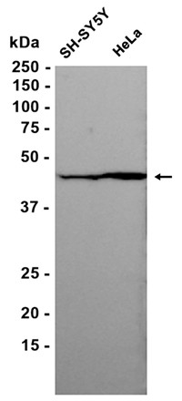 AYD15840