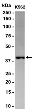 AYD15164