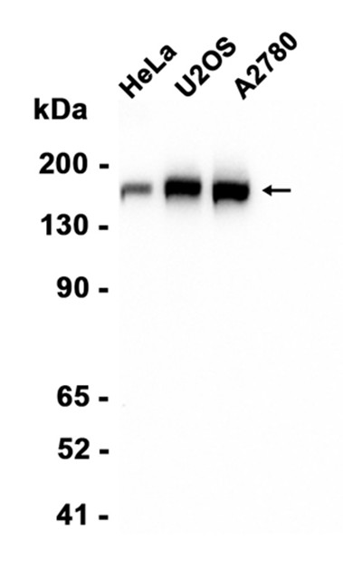 FANCD2 (YD13096) Rabbit mAb