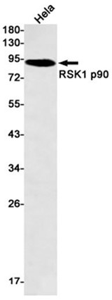 AYD14657