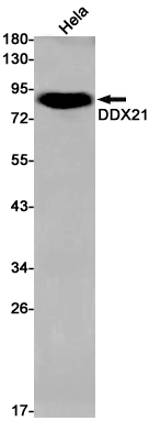 AYD11661