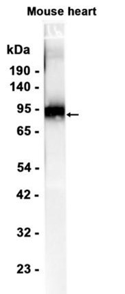 CD39 (YD19532) Rabbit mAb