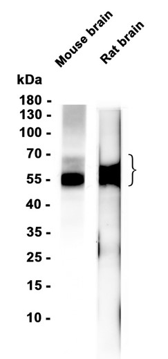 Tau (phospho T205) (YD35705) Rabbit mAb