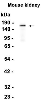 AYD14433