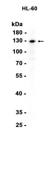 AYD14665