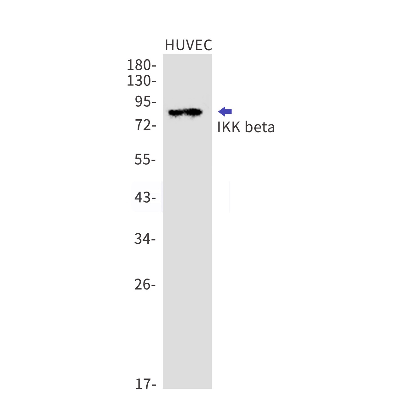 IKK beta (YD14092) Rabbit mAb