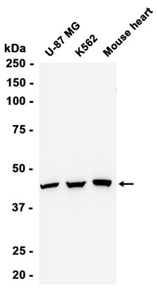 AYD12638