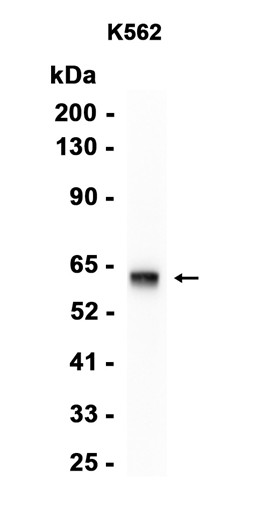 AYD15794
