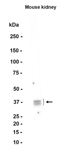 Cytokeratin 19 (YD15363) Rabbit mAb