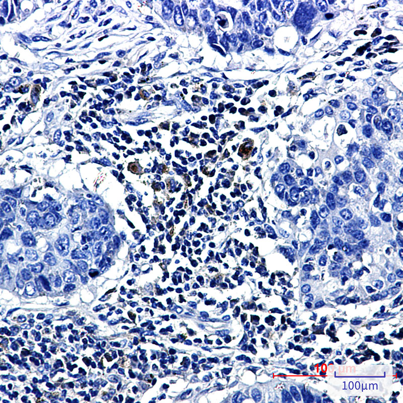 AYD12522-ihc1