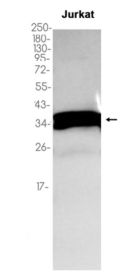 PPP2CA/B (YD12786) Rabbit mAb
