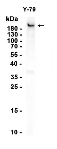 MYO7A (YD36172) Rabbit mAb