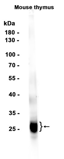 CD8B (YD19205) Rabbit mAb