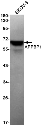 AYD14774