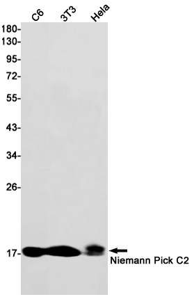 Niemann Pick C2 (YD14649) Rabbit mAb