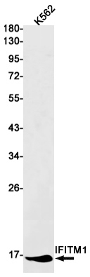 AYD11409