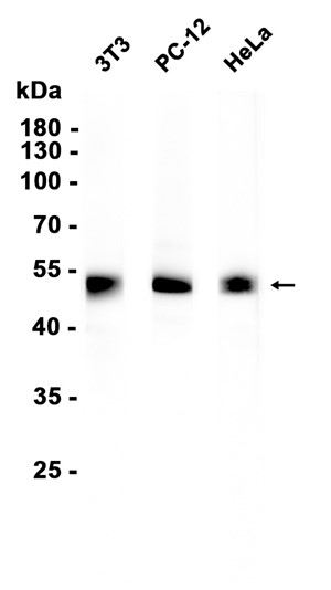 GATA2/GATA3 (YD35575) Rabbit mAb
