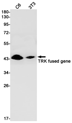 TRK fused gene (YD16148) Rabbit mAb