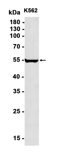 AYD12585