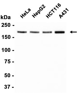 AYD11699