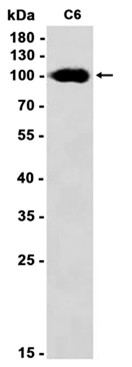 AYD11874